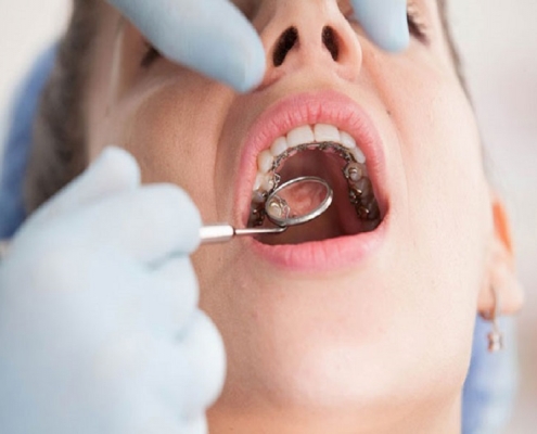  ارتودنسی دندان