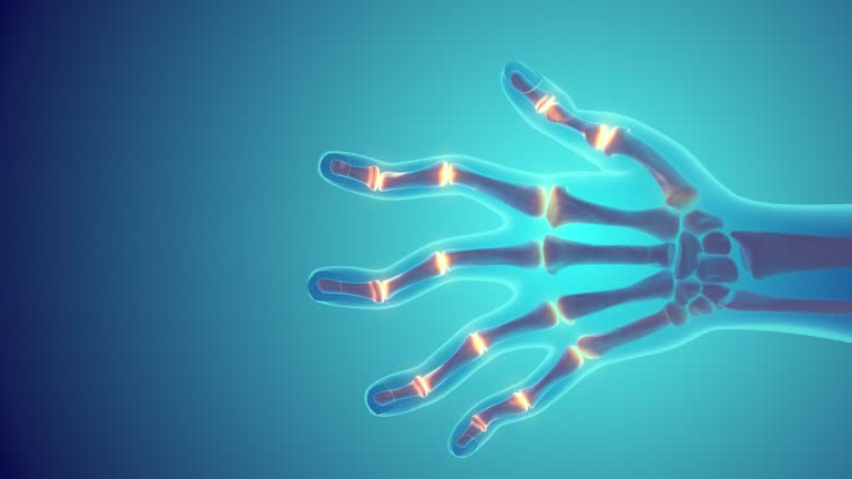 علائم روماتیسم مفصلی