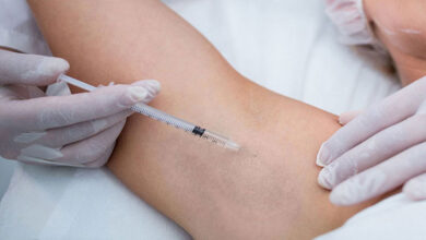 تزریق بوتاکس زیر بغل