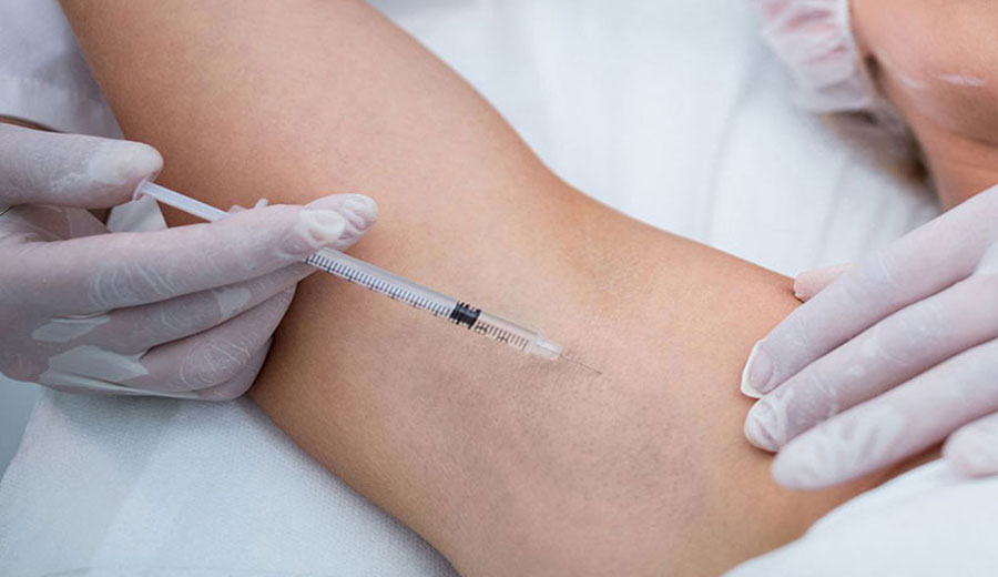 تزریق بوتاکس زیر بغل