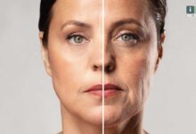 بهترین روش های جوانسازی پوست بدون جراحی