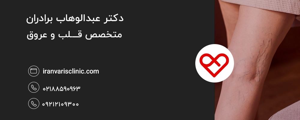 تاثیر سرما بر واریس