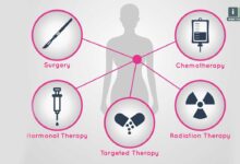 تازه‌ترین روش های درمان سرطان سینه در سال ۲۰۲۵ که جان بیماران را نجات میدهد