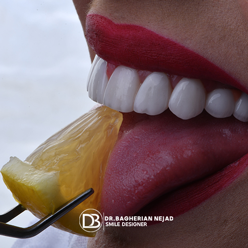 خدمات زیبایی دندان اصفهان