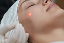 اندولیفت، تنها روش لیفت صورت که چهره را مصنوعی نمی‌کند!