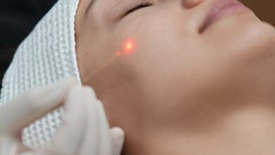 اندولیفت، تنها روش لیفت صورت که چهره را مصنوعی نمی‌کند!