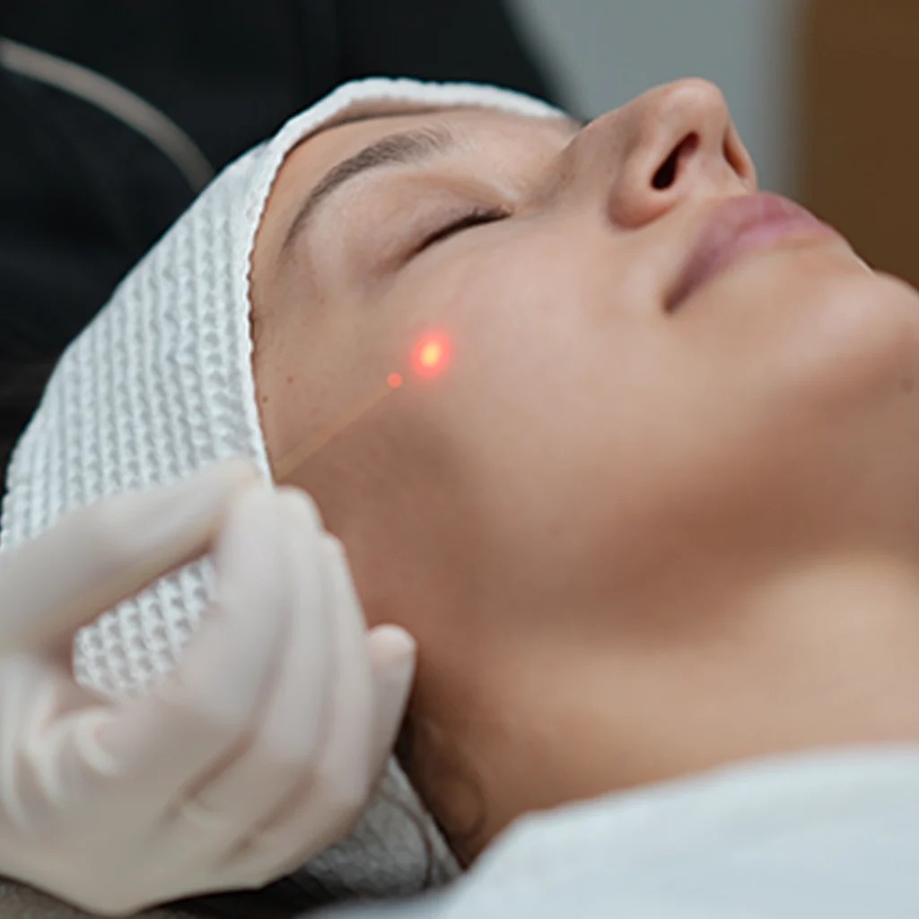 اندولیفت، تنها روش لیفت صورت که چهره را مصنوعی نمیکند!