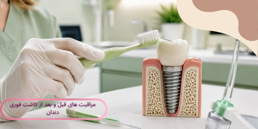 مراقبت های قبل و بعد از کاشت فوری دندان