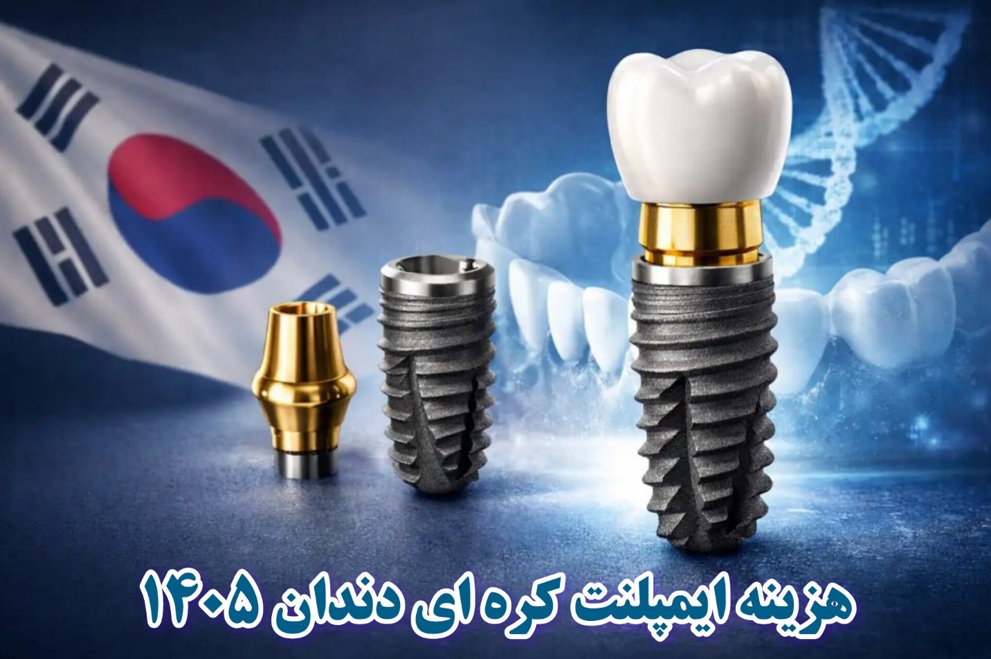 قیمت ایمپلنت کره ای با روکش