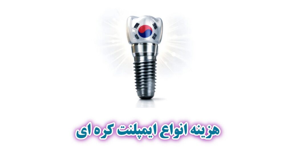 قیمت انواع ایمپلنت کره ای